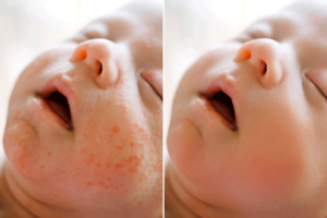 High-End Smooth Skin Action