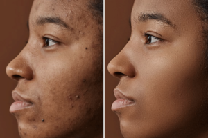 High-End Smooth Skin Action